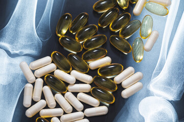 Close-up of X-ray image and different pills and capsules