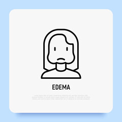 Edema thin line icon, woman with swollen cheeks. Allergy symptom. Modern vector illustration