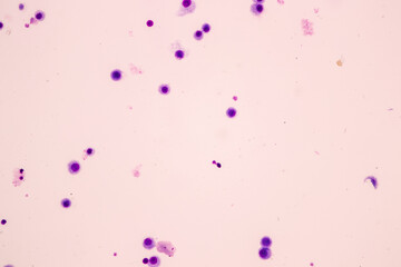 Chromosomes Human under the microscope for education.
