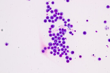 Chromosomes Human under the microscope for education.
