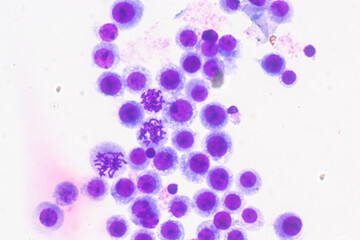 Chromosomes Human under the microscope for education.
