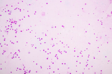 Chromosomes Human under the microscope for education.
