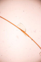 The head louse (Pediculus humanus capitis) is a parasite Live on the body, person or animal and...