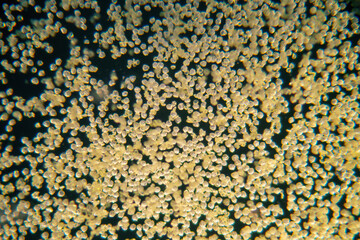 pollen particles as an allergy factor