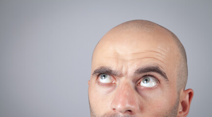 Caucasian bald man in office. Hair loss concept