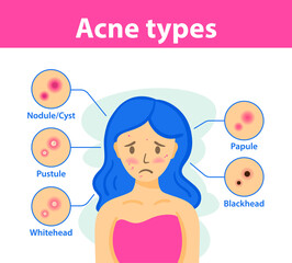 Fototapeta premium Types of acne, causes of the disease, treatment. Infographics of acne.