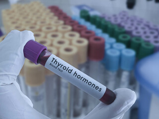 Thyroid hormone test