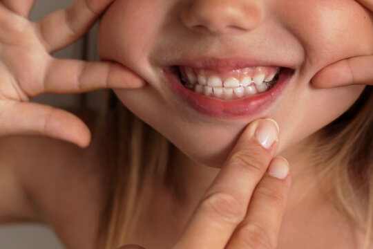 Little girl smiles and shows her snow-white smile, teeth. The child is brushing his teeth.