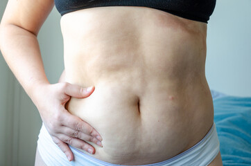 closeup on woman belly, overweight adiposity, fat, real body