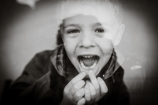 Black and white image of kid showing off his lost teeth