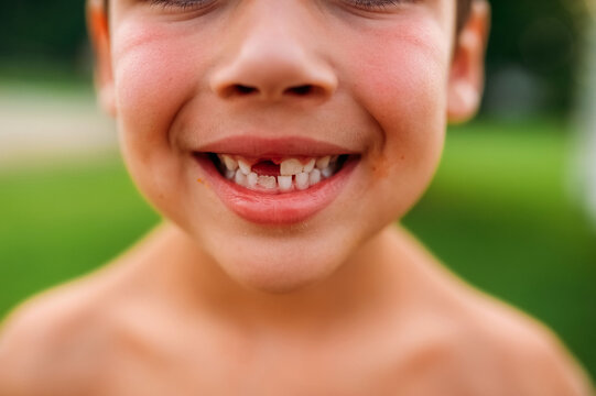 Closeup portrait of a child's gappy smile. 
