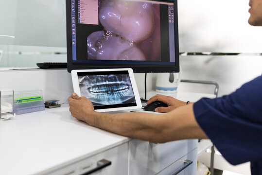 Male dentist at work