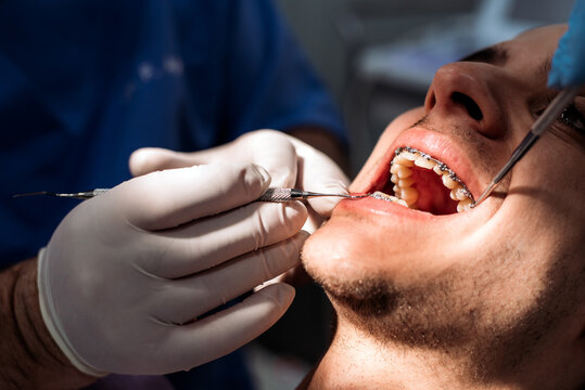 Dentist fixing patient's teeth braces