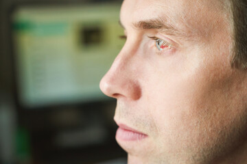 Man damaged eye ball. Conjunctivitis blood. Allergy ophtalmology test. Medical redness concept....