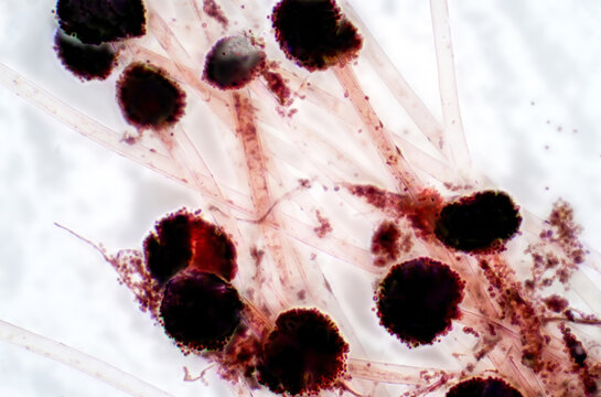 Aspergillus (mold) under the light microscopic view.