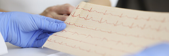 Doctor in gloves holds patient cardiogram closeup