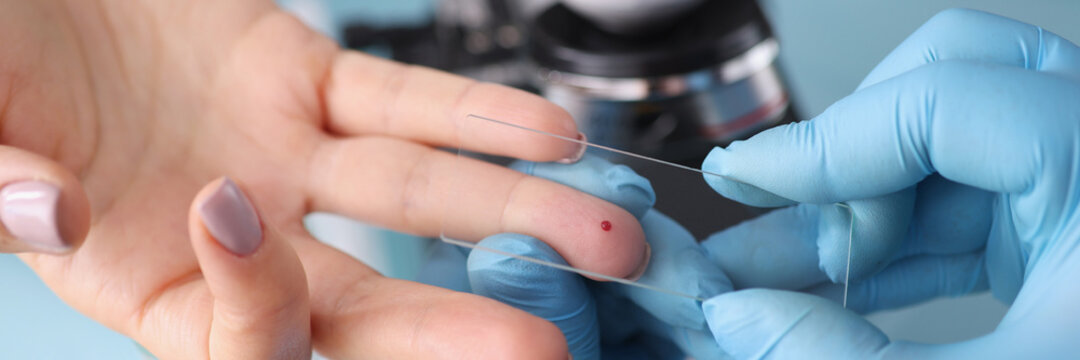 Taking a blood test for examination in patients