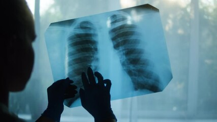 Studying X-ray image of human chest on window background, doctor checking fluorography of patient on light, lungs check-up after coronavirus pandemic. Looking at lungs x-ray with ribs. - Powered by Adobe