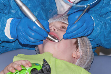 Children's dentist treats a tooth. The process of working with a dental drill
