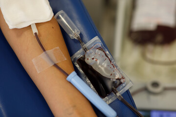 blood sampling in the laboratory, donation, dressing,