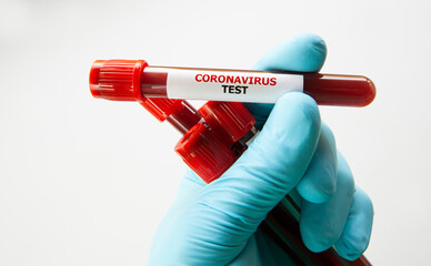 The nurse holding tube of blood test with the label Coronavirus test