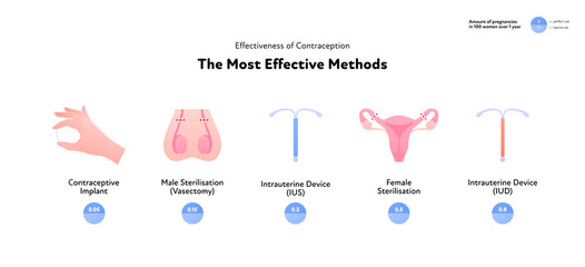 Effectiveness of contraception method infographic. Vector flat color icon illustration. Most effective contraceptive methods. Pearl rate index. Design for birth control and pregnancy prevention.