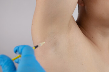 Man receiving botox injection in armpit as treatment of hyperhidrosis in clinic. Treatment of problems with increased sweating, anhidrosis, or malfunctioning glands. Botulinum toxin in cosmetology