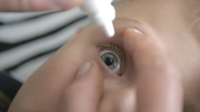 Hand dripping eye drops in child eyes. Allergy and conjunctivitis treatment.