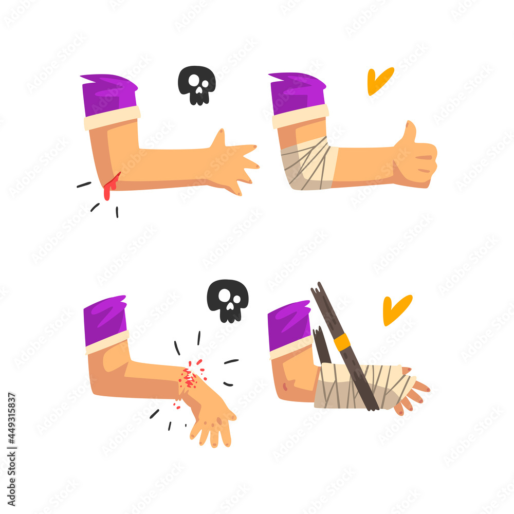 Poster First Aid for Wounded Bloody Elbow and Arm Fracture Vector Set