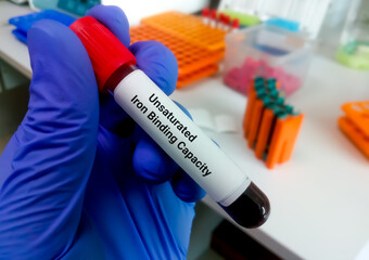 Blood sample for unsaturated iron binding capacity (UIBC)
