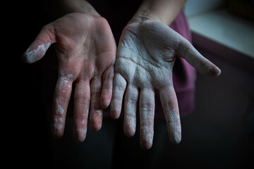beautiful women's hands smeared in white paint after working with their hands . home renovation. painting works. hands covered in paint. whitewashing the texture