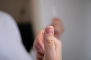 nail care. the girl sharpens her nails with a nail file. a broken nail. girl takes care of manicure manicure nail file thumb broken nail