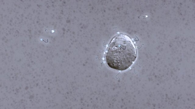 Sperm Cells Under Microscope At Research Laboratory. Sperm Cells Moving To Ova. Studding Sperm Cells By Visual Observation. Scaled View. Grey Background. Medical Research Of Insemination. Close up