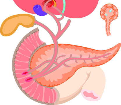 Pancreatic Ducts Images Browse 249 Stock Photos Vectors And Video Adobe Stock