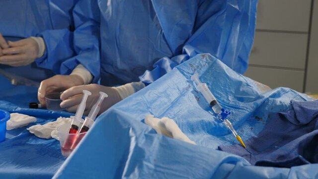 Vascular surgery. Radiologist performs endovascular operation with angiography machine. Doctor using contrast liquid for uterine fibroid embolization. Cardio-vascular examination. 4k video