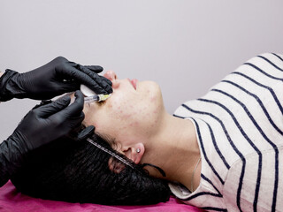 Cosmetologist doctor is making multiple injections biorevitalization with hyaluronic acid in woman...
