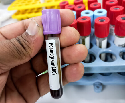 Blood sample tube with sample for hemogram or CBC test, other test sample background