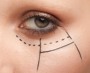 female eye area with perforation lines, platic surgery concept