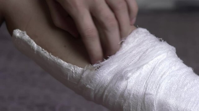Itching under plaster bandage. Woman scratches broken leg, close-up. High quality FullHD footage. 50 FPS, downscaling.