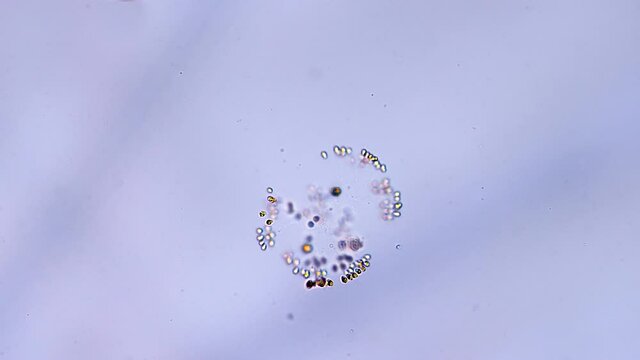 In the microscope, a group of protozoa united in a sphere revolve in water taken from a pond. Closeup. Macro