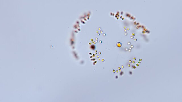 In the microscope, a group of protozoa united in a sphere revolve in water taken from a pond. Closeup. Macro