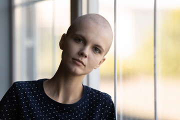 Head shot portrait of young millennial woman with shaved head suffering from oncological disease....