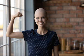 Happy strong cancer survivor winning fight for life, beating disease. Young woman with shaved head...