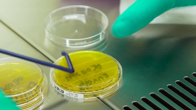 microbiologist with a bacterial loop collects bacteria culture from a petri dish for analysis.