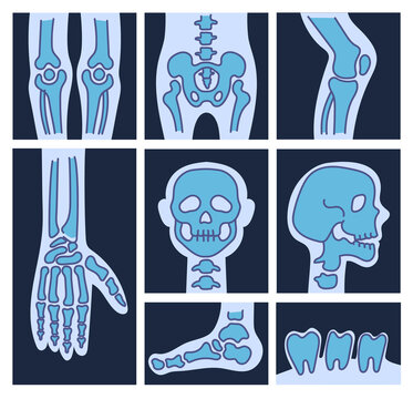 X ray skeleton bones skull foot finger leg tooth isolated set. Vector flat cartoon graphic illustration