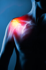 Human shoulder joint in x-ray on blue background. Shoulder joint is highlighted by yellow red...