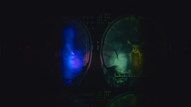 Magnetic resonance tomography (mri) of the human brain. Colorful illumination of brain images. Closeup. Macro