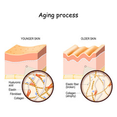Aging process