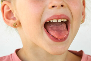 saliva. Drooling on the tongue in kid mouth. Cheerful smile child. close-up of face on white...