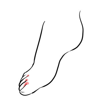 水虫 Images Browse 469 Stock Photos Vectors And Video Adobe Stock